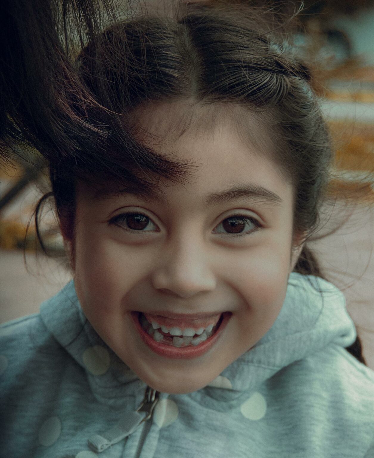 What’s An Overbite? Signs, Causes, & Treatments - Orthodonticscolorado.com