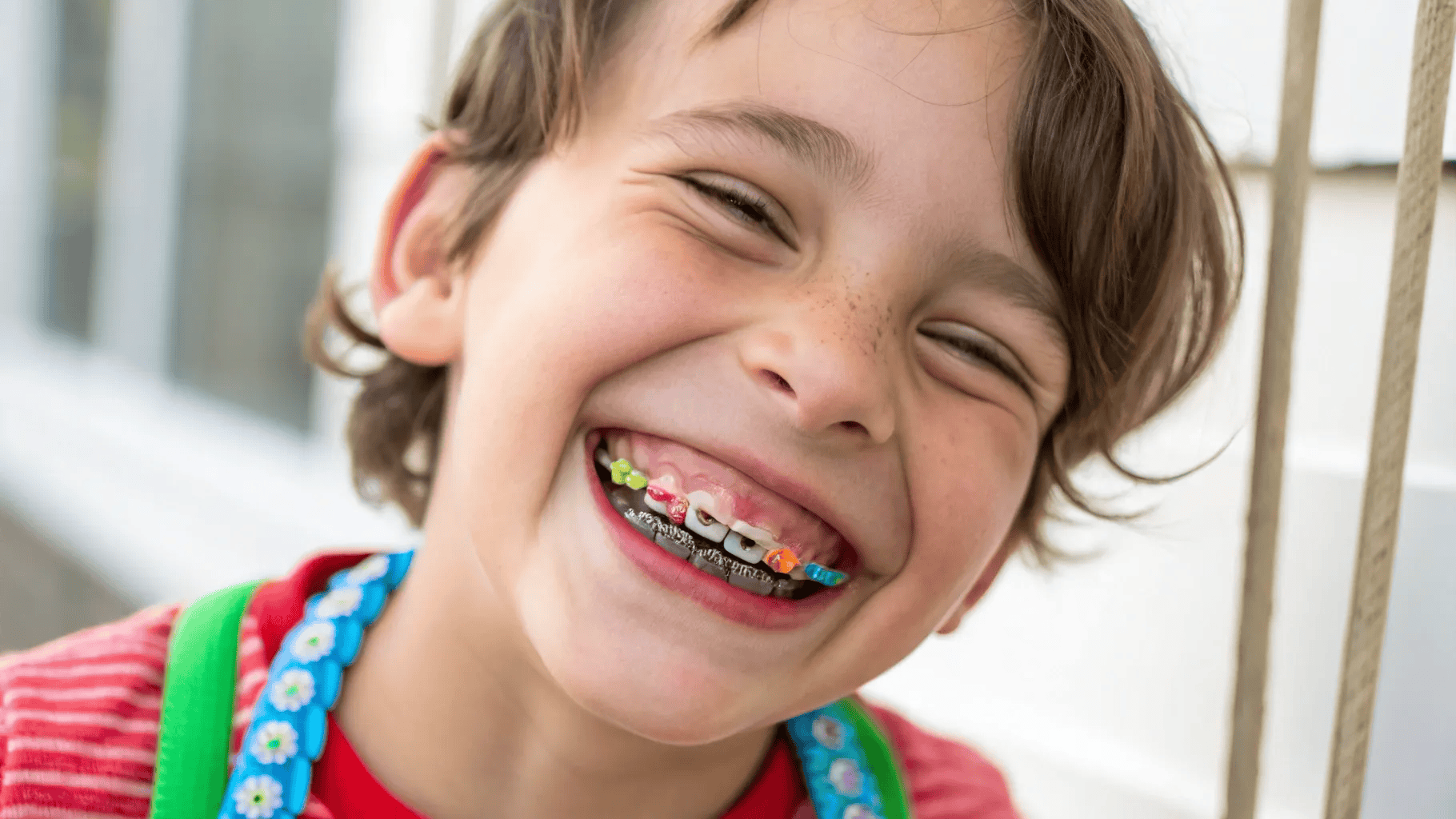 11b07987 6d5e 42ed b4a2 6971e40218a8 Why Do Kids Need Braces? When Early Orthodontic Treatment is Necessary