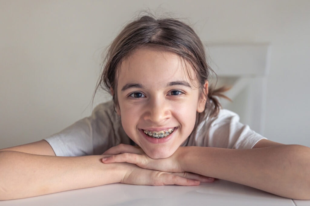 Here’s What to Eat With Braces the First Week 5 Talk to Your Local Orthodontist About Managing the First Week of Braces